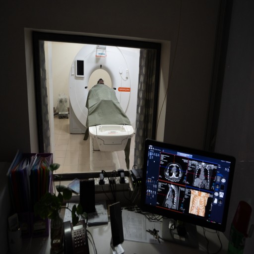 Successful Treatment of Brain Stroke